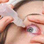 5 روش درمان حساسیت چشمی + انواع آلرژی چشمی