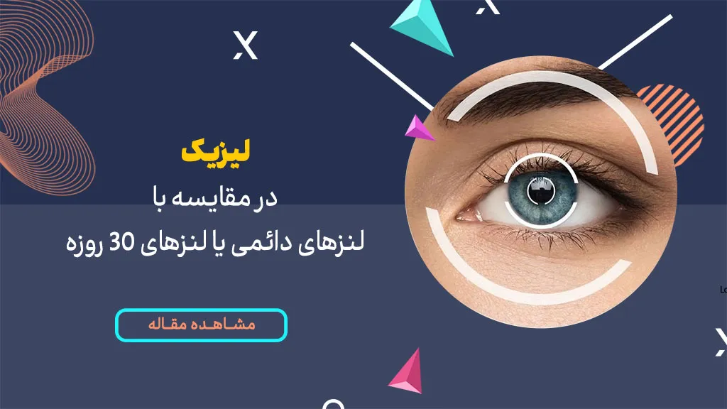 لیزیک در مقایسه با لنزهای دائمی یا لنزهای 30 روزه