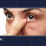 راهنمای خارج کردن جسم خارجی از داخل چشم