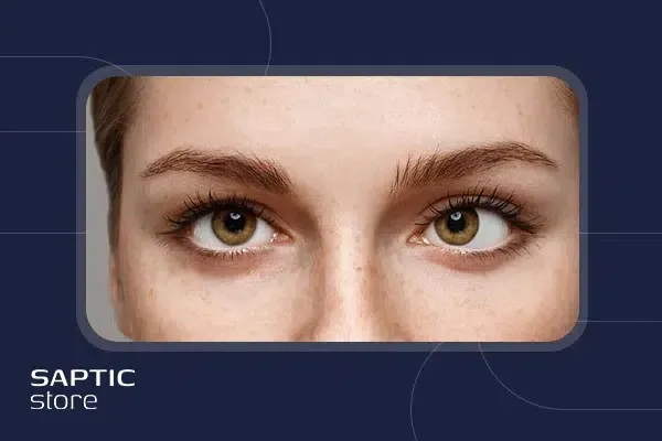 همه چیز درباره انحراف چشم، علائم و درمان