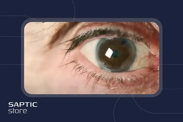 ارتباط ضعیفی چشم با انواع بیماری های سیستمیک