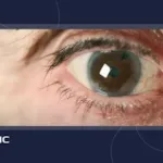 ارتباط ضعیفی چشم با انواع بیماری های سیستمیک