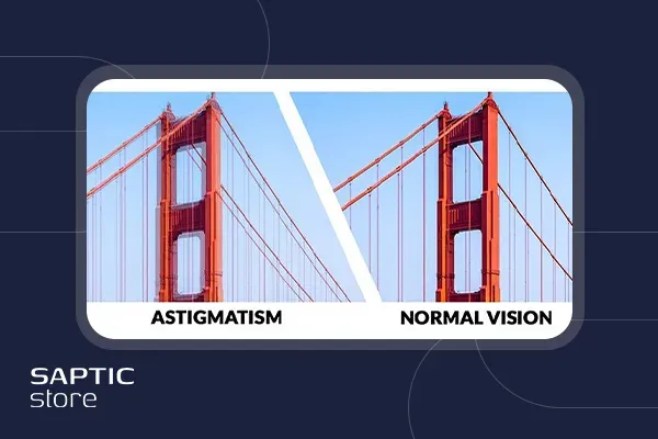 آستیگماتیسم  چشم + تشخیص، علائم و درمان آن